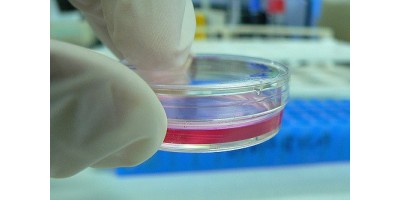4 Cell Culture Hazards to Avoid