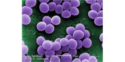 New Beta Lactams Help Kill Drug Resistant Bacteria