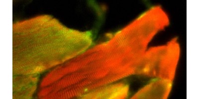 Hand-held Microscope Images Muscle Microstructure and Dynamics