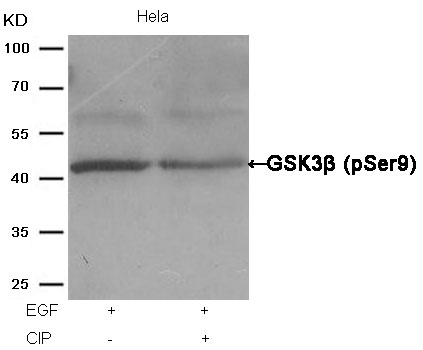 GSK3β (Phospho Ser9) Antibody