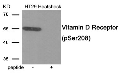 Vitamin D Receptor (Phospho Ser208) Antibody