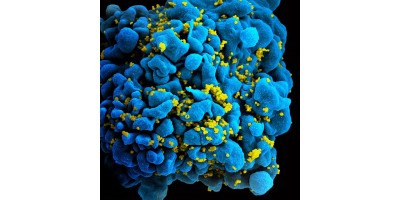 Punch - Counterpunch:  HIV Can Avoid CRISPR/Cas9 Editing