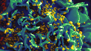 Researchers Find Alternative Pathways to HIV Antibodies